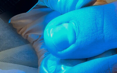 Advanced Foot Care: Treating and Preventing Common Foot Issues